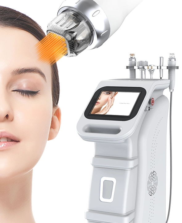 Benefícios do vácuo RF Microneedling