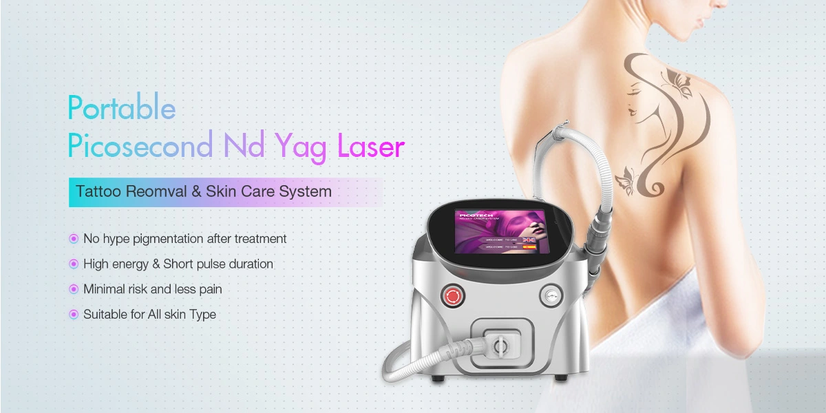 Remoção de tatuagem portátil Micro Laser Máquina de Vídeo