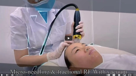 Vídeo da máquina de vácuo vertical Microneedling RF