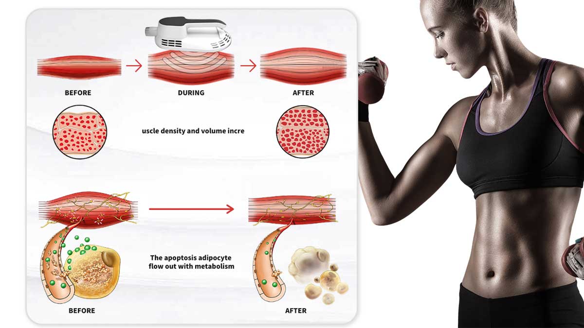 Fat Burning Ems Machine of Manufactuers