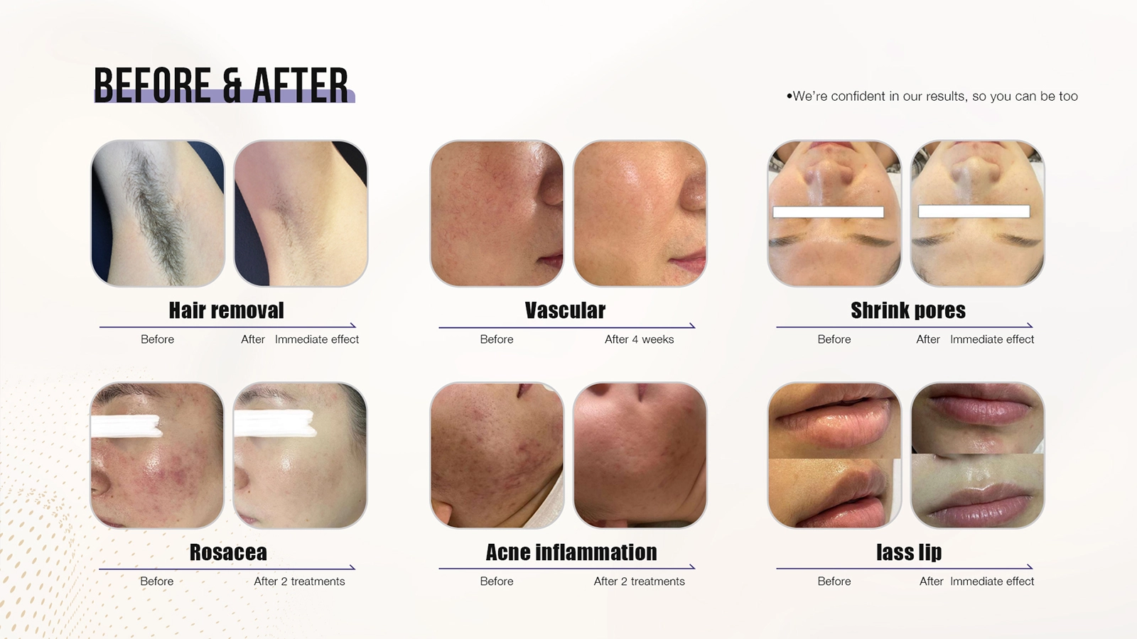 Rejuvenescimento da pele a laser impressionante antes e depois dos resultados e dicas essenciais de cuidados posteriores