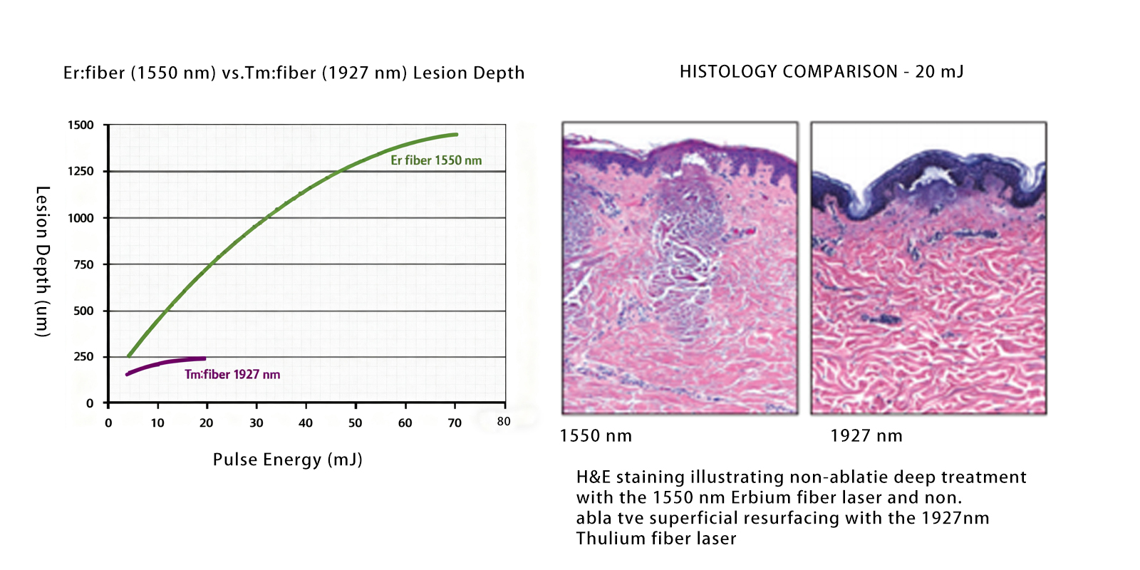 Comparative-Analysis-of-1927nm-and-1550nm-in-Treatment-Depth